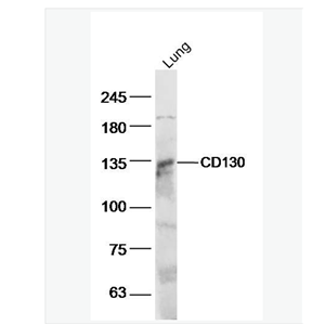 Anti-IL6ST/CD130 antibody-白细胞介素6受体β/CD130抗体,IL6ST/CD130