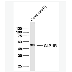 Anti-GLP-1R antibody-胰高血糖素样肽-1受体/GLP-1受体抗体