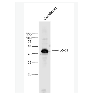 Anti-LOX 1 antibody-凝集素样氧化型低密度脂蛋白受体抗体