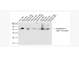 Anti-Angiotensin II type 1A receptor antibody-血管紧张素Ⅱ1A型受体抗体