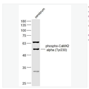 Anti-phospho-CaMK2 alpha (Tyr230) antibody-磷酸化钙/钙调素依赖蛋白激酶2α抗体,phospho-CaMK2 alpha (Tyr230)