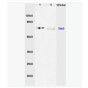 Anti-Phospho-IRAK1 (Thr387) antibody-磷酸化白介素-1受体相关激酶1抗体