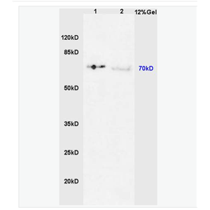 Anti-Phospho-IRAK1 (Thr387) antibody-磷酸化白介素-1受體相關(guān)激酶1抗體,Phospho-IRAK1 (Thr387)