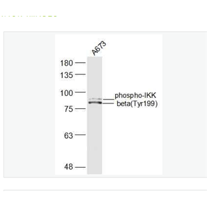 Anti-phospho-IKK beta (Tyr199) antibody-磷酸化KB抑制蛋白激酶β抗体,phospho-IKK beta (Tyr199)