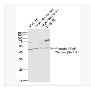 Anti-Phospho-PPAR Gamma (Ser112) antibody-磷酸化过氧化酶活化增生受体γ抗体