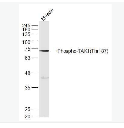 Anti-Phospho-TAK1 (Thr187) antibody-磷酸化转化生长因子β活化激酶1,Phospho-TAK1 (Thr187)