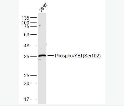 Anti-Phospho-YB1 (Ser102) antibody-磷酸化转化生长因子β活化激酶1,Phospho-YB1 (Ser102)