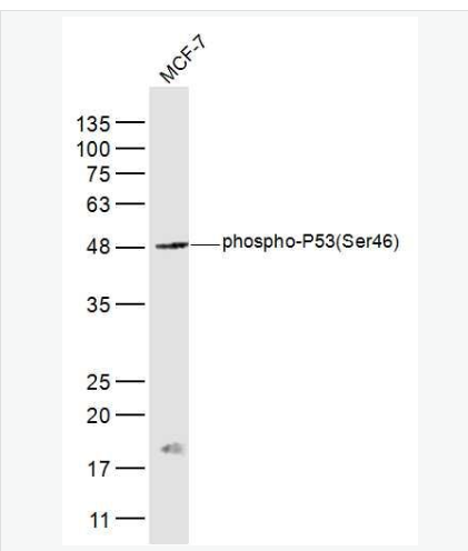 Anti-phospho-P53 (Ser46) antibody-磷酸化肿瘤抑制基因P53抗体,phospho-P53 (Ser46)