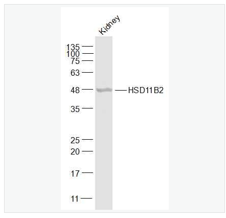 Anti-HSD11B2 antibody-羟基类固醇脱氢酶11β2抗体,HSD11B2