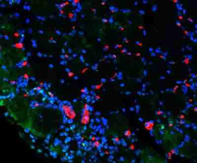 TUNEL檢測(cè) （熒光）,TUNEL Detection (Fluorescence)