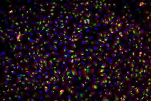 組織芯片免疫熒光（雙標(biāo)）,Tissue chip immunofluorescence (double standard)