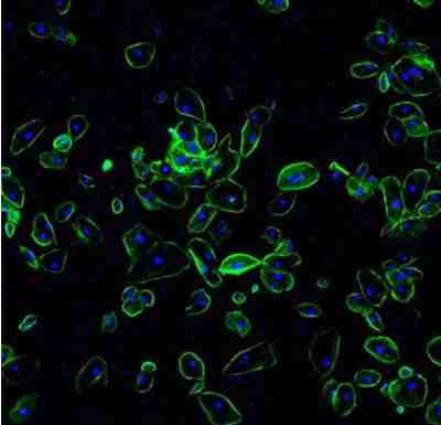 组织芯片免疫荧光（单标）,Tissue chip immunofluorescence (single standard)