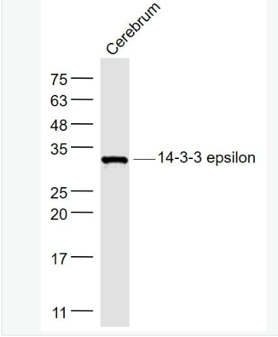 Anti-14-3-3 epsilon antibody-14-3-3E蛋白抗體,14-3-3 epsilon