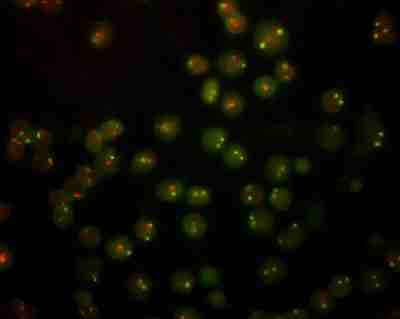 原位雜交實(shí)驗(yàn)（DAB顯色）,In situ hybridization experiment (DAB chromogenization)