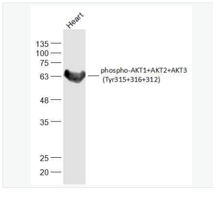 Anti-phospho-AKT1+AKT2+AKT3 (Tyr315+316+312)  antibody-磷酸化蛋白激酶AKT1,2,3抗体,phospho-AKT1+AKT2+AKT3 (Tyr315+316+312)