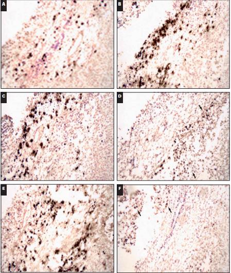 骨组织脱钙（快脱）,Decalcification of bone tissue (quick decalcification)