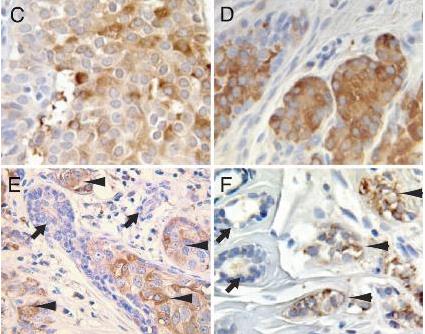 免疫组化（IHC）,Immunohistochemistry (IHC)