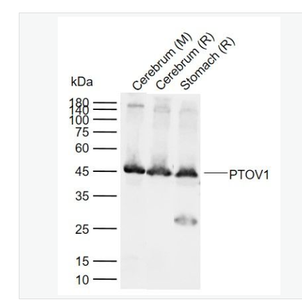 Anti-PTOV1 antibody-前列腺肿瘤高表达蛋白1抗体,PTOV1