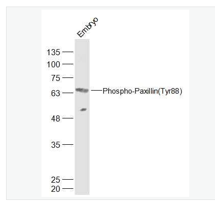 Anti-Phospho-Paxillin (Tyr88) antibody-磷酸化樁蛋白Paxillin抗體,Phospho-Paxillin (Tyr88)