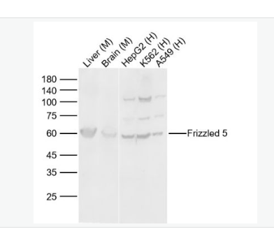 Anti-Frizzled 5 antibody-Wnt信号受体蛋白抗体,Frizzled 5