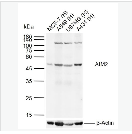 Anti-AIM2 antibody-干扰素诱导蛋白AIM2抗体,AIM2