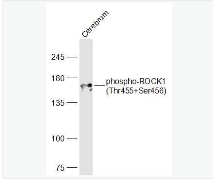 Anti-phospho-ROCK1 (Thr455+Ser456) antibody-磷酸化Rho相关蛋白激酶1抗体,phospho-ROCK1 (Thr455+Ser456)