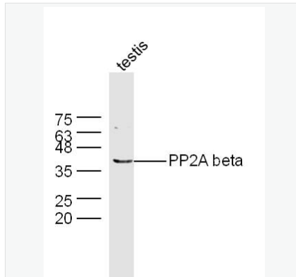 Anti-PP2A alpha + beta antibody-蛋白質(zhì)磷酸酶2A （alpha + beta）抗體,PP2A alpha + beta