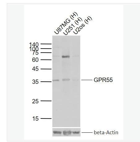 Anti-GPR55 antibody-蛋白偶联受体55抗体,GPR55