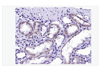 Anti-ALAS1 antibody-5-氨基乙酰丙酸合酶1抗体,ALAS1