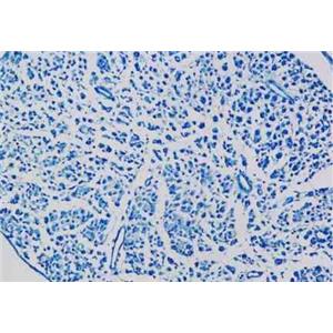 LFB髓鞘染色/固蓝染色服务-艾普蒂生物