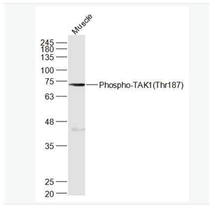 Anti-Phospho-TAK1 (Thr187) antibody-磷酸化转化生长因子β活化激酶1