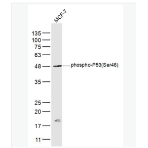 Anti-phospho-P53 (Ser46) antibody-磷酸化肿瘤抑制基因P53抗体