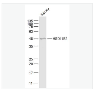Anti-HSD11B2 antibody-羟基类固醇脱氢酶11β2抗体