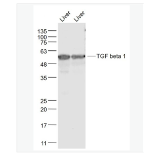 Anti-TGF beta 1 antibody-转化生长因子β1/TGF β1/TGF-β1抗体