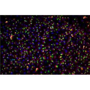 组织芯片免疫荧光（双标）-艾普蒂生物