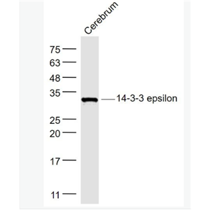 Anti-14-3-3 epsilon antibody-14-3-3E蛋白抗体