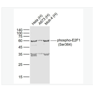Anti-phospho-E2F1 (Ser364) antibody-磷酸化转录因子E2F-1抗体,phospho-E2F1 (Ser364)