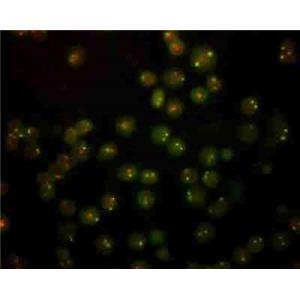 原位雜交實(shí)驗(yàn)（DAB顯色）,In situ hybridization experiment (DAB chromogenization)