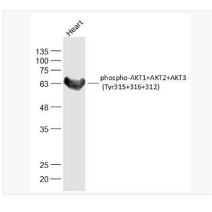 Anti-phospho-AKT1+AKT2+AKT3 (Tyr315+316+312)  antibody-磷酸化蛋白激酶AKT1,2,3抗体,phospho-AKT1+AKT2+AKT3 (Tyr315+316+312)