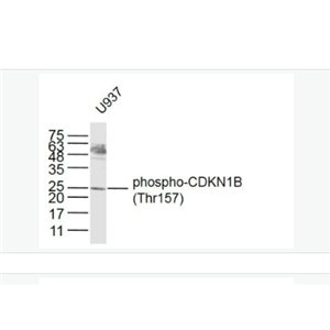 Anti-phospho-CDKN1B (Thr157) antibody-磷酸化P27抗体/周期素依赖激酶抑制剂抗体