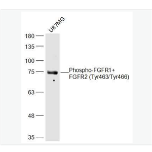 Anti-Phospho-FGFR1+FGFR2 (Tyr463/Tyr466)  antibody-磷酸化碱性成纤维细胞生长因子受体1/2（CD331/CD332）抗体