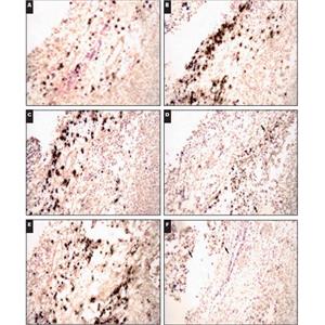 骨组织脱钙（快脱）,Decalcification of bone tissue (quick decalcification)