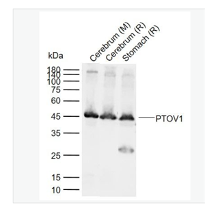 Anti-PTOV1 antibody-前列腺肿瘤高表达蛋白1抗体