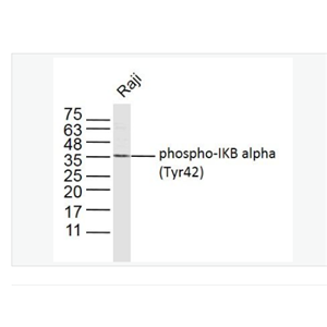 Anti-phospho-IKB alpha (Tyr42)  antibody-磷酸化IKB α抗体