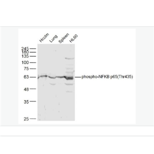 Anti-phospho-NFKB p65 (Thr435) antibody-磷酸化细胞核因子抗体