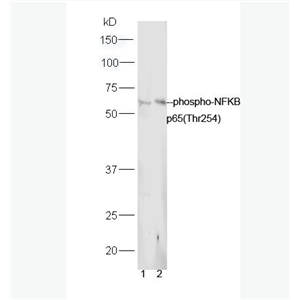 Anti-phospho-NFKB p65 (Thr254) antibody-磷酸化细胞核因子抗体