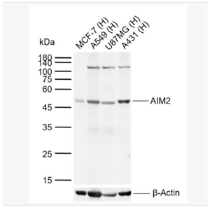 Anti-AIM2 antibody-干扰素诱导蛋白AIM2抗体