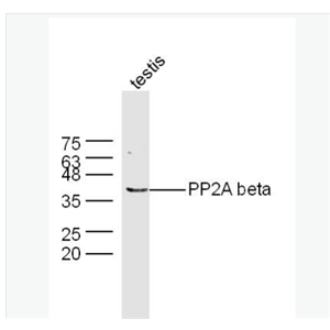 Anti-PP2A alpha + beta antibody-蛋白质磷酸酶2A （alpha + beta）抗体