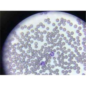 外周血单核细胞PBMC分离