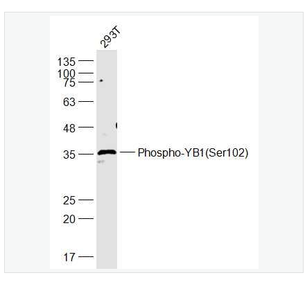 Anti-Phospho-YB1antibody-磷酸化核酸酶敏感元件結(jié)合蛋白1抗體,Phospho-YB1 (Ser102)